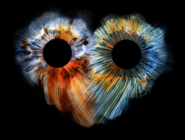 Couple Iris Photos